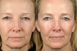 Best Skincare Treatment Clinic in Islamabad