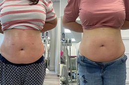 Best Weight Loss Treatment Clinic in Islamabad