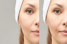 Best glutathione injections Clinic in Islamabad