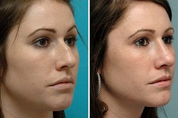 Cosmetic Surgery Clinic in Islamabad