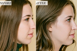 Cosmetic Surgery in Islamabad