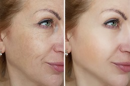 Skincare Treatment Clinic in Islamabad