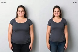 Weight Loss Treatment Clinic in Islamabad