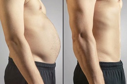 Fat Reduction in Islamabad