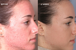  Pigmentation Treatment Clinic in Islamabad